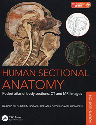 Human Sectional Anatomy: Pocket Atlas of Body Sections, CT and MRI Images von CRC Press